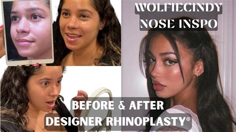 wolfiecindy nose|cindy inspo nose before and after.